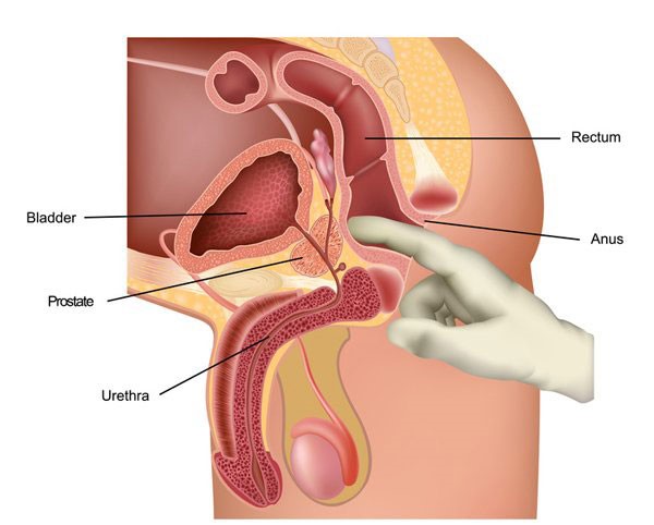 Prostrate Gland